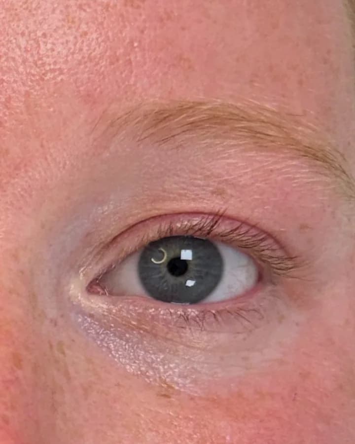 Eén oog van dichtbij voor de behandeling, met een lichte wenkbrauw en rechte wimpers