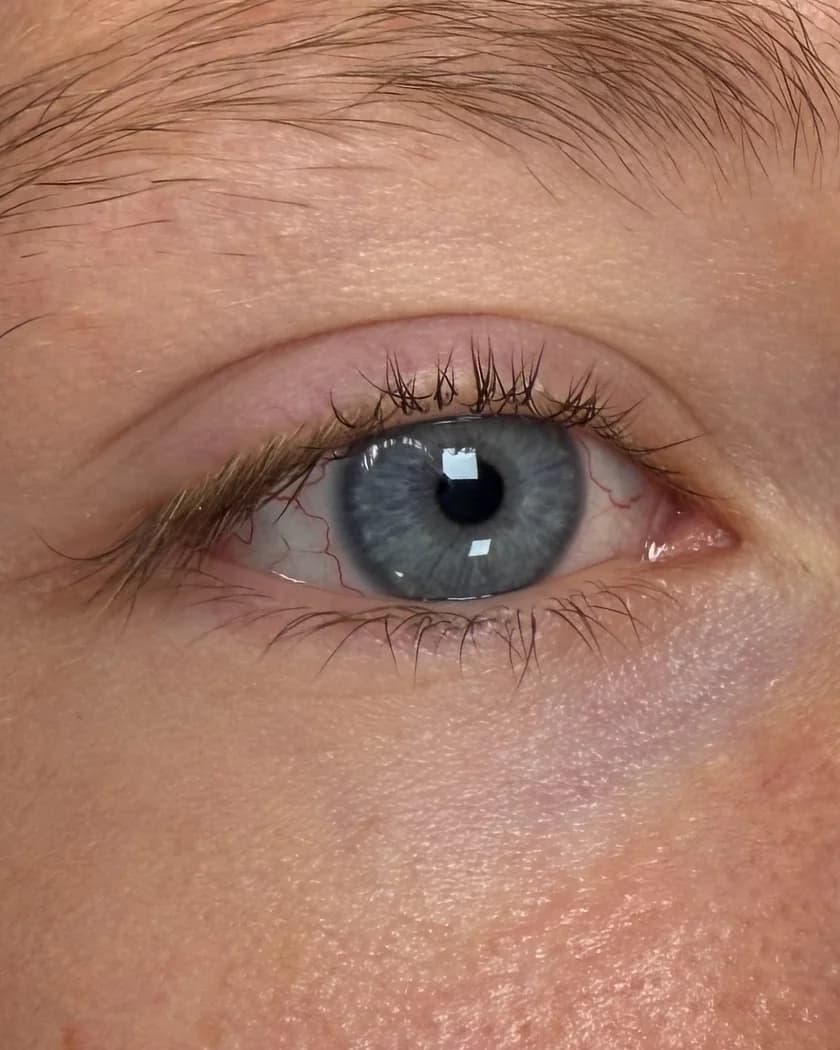 Een blauw oog met lichtblonde, rechte wimpers voor de behandeling