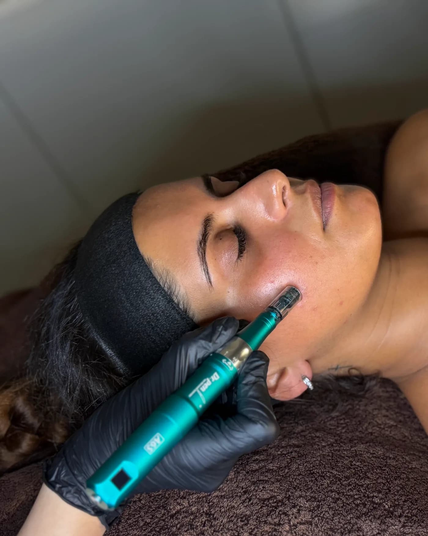 Een microneedling-pen op de kaak van een klant die met een haarband om op de behandeltafel ligt